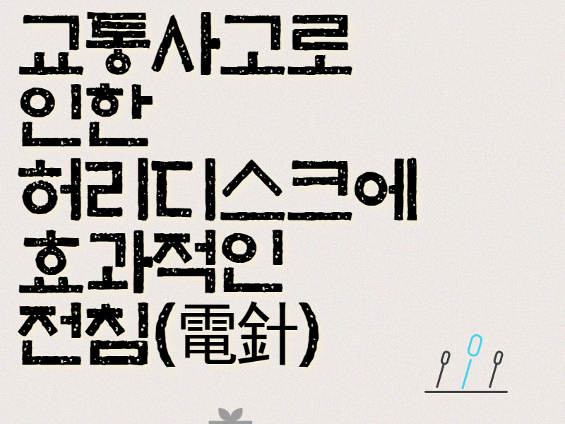 [칼럼] 교통사고 허리디스크통증에 효과적인 전침