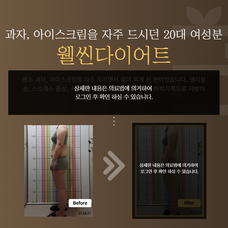 과자, 아이스크림을 자주 드시던 20대 여성분 웰씬다이어트