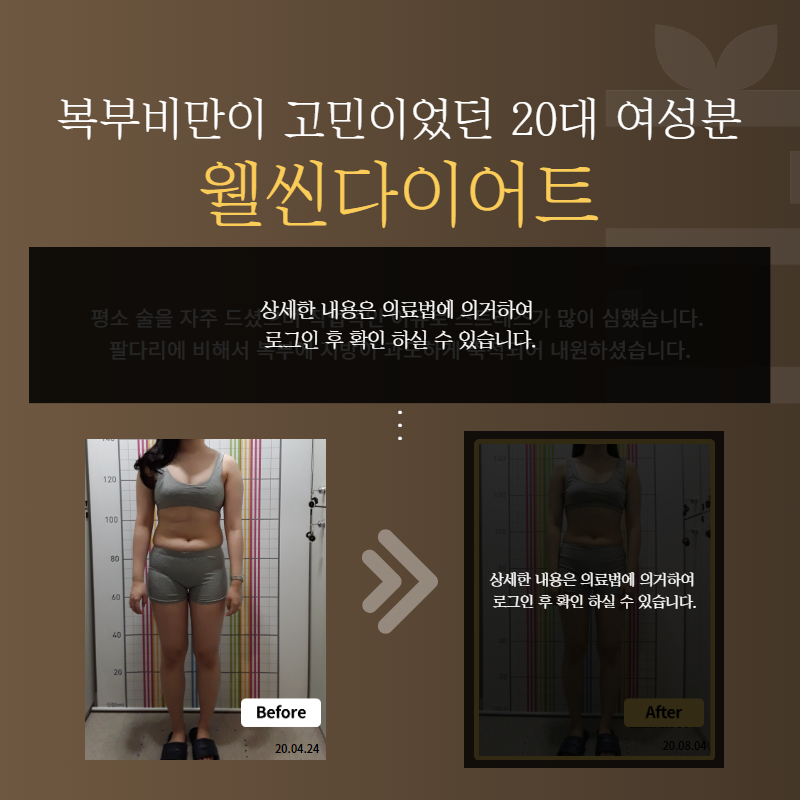 복부비만이 고민이었던 20대 여성분 웰씬다이어트