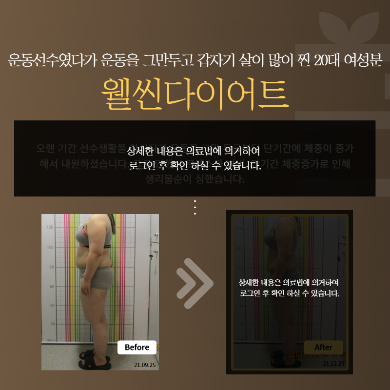 운동선수였다가 운동을 그만두고 갑자기 살이 많이 찐 20대 여성분 웰씬다이어트