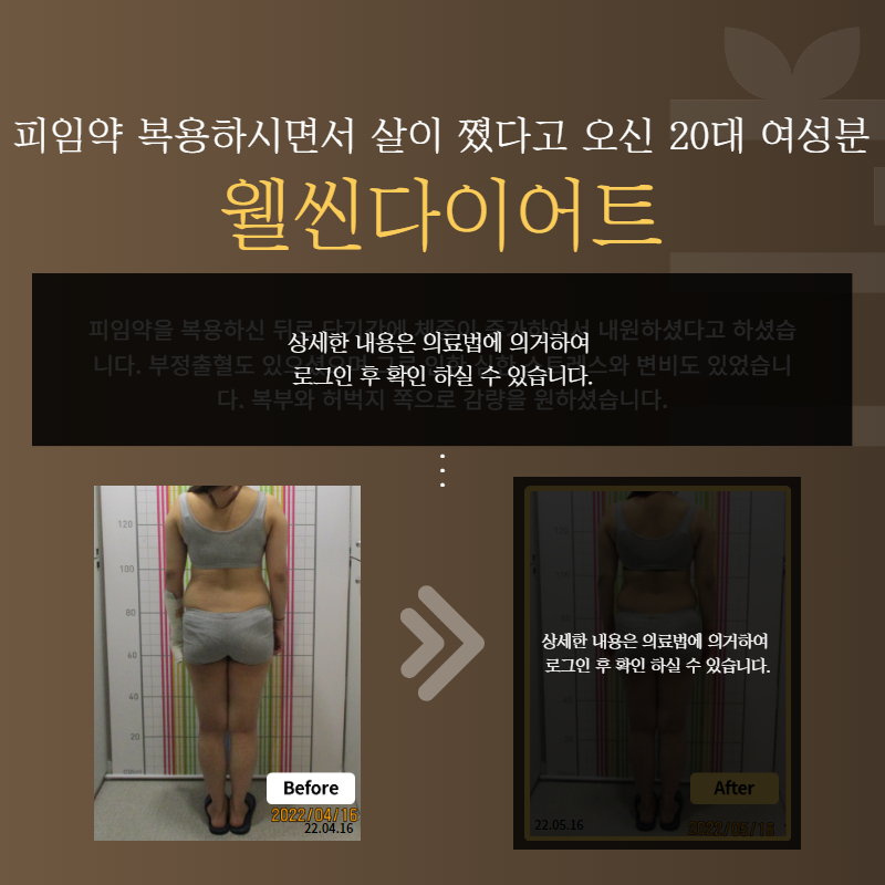 피임약 복용하시면서 살이 쪘다고 오신 20대 여성분 웰씬다이어트