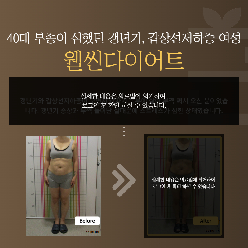40대 부종이 심했던 갱년기, 갑상선저하증 여성 웰씬다이어트