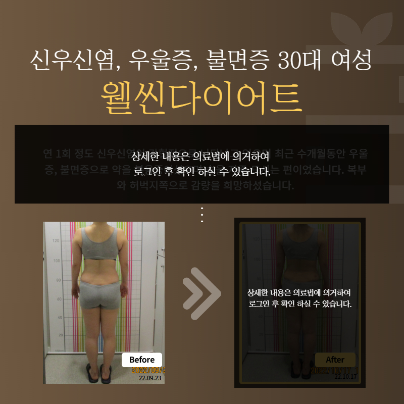 신우신염, 우울증, 불면증 30대 여성 웰씬다이어트