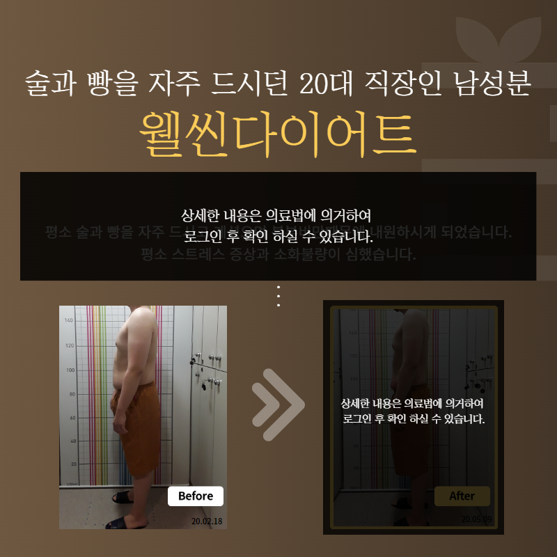 술과 빵을 자주 드시던 20대 직장인 남성분 웰씬다이어트