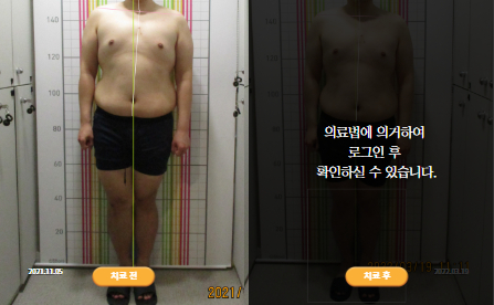 바로선치료 [20대 남성] 턱관절