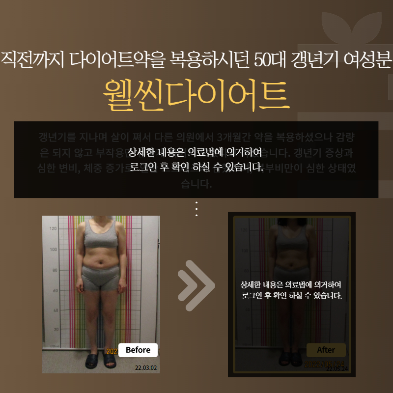 직전까지 다이어트약을 복용하시던 50대 갱년기 여성분 웰씬다이어트