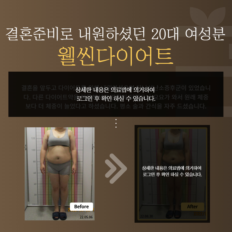 결혼준비로 내원하셨던 20대 여성분 웰씬다이어트