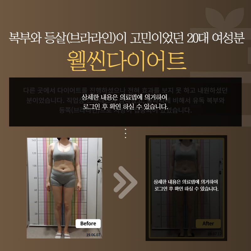 복부와 등살(브라라인)이 고민이었던 20대 여성분 웰씬다이어트