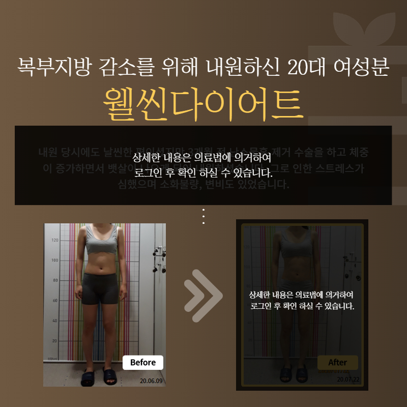 복부지방 감소를 위해 내원하신 20대 여성분 웰씬다이어트