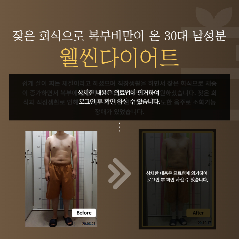 잦은 회식으로 복부비만이 온 30대 남성분 웰씬다이어트