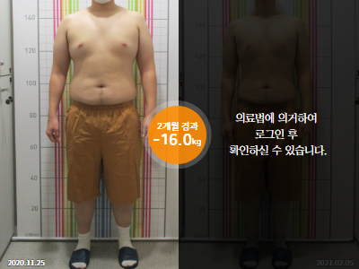 웰씬다이어트 [20대 남성] 2개월 경과 총-16kg 감량