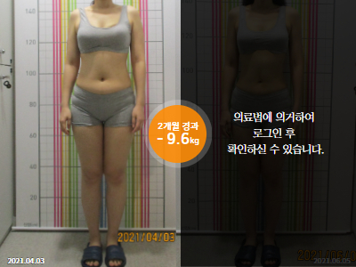 웰씬다이어트 [30대 여성] 2개월 경과 총-9.6kg 감량