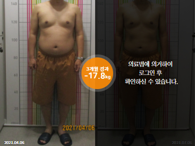 웰씬다이어트 [40대 남성] 3개월 경과 총-17.8kg 감량