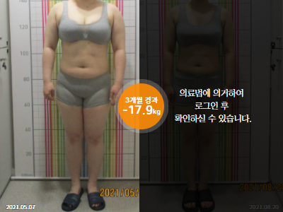 웰씬다이어트 [20대 여성] 3개월 경과 총-17.9kg 감량