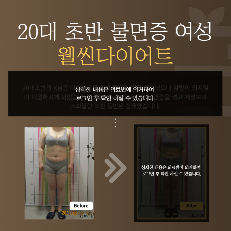 20대 초반 불면증 여성 웰씬다이어트