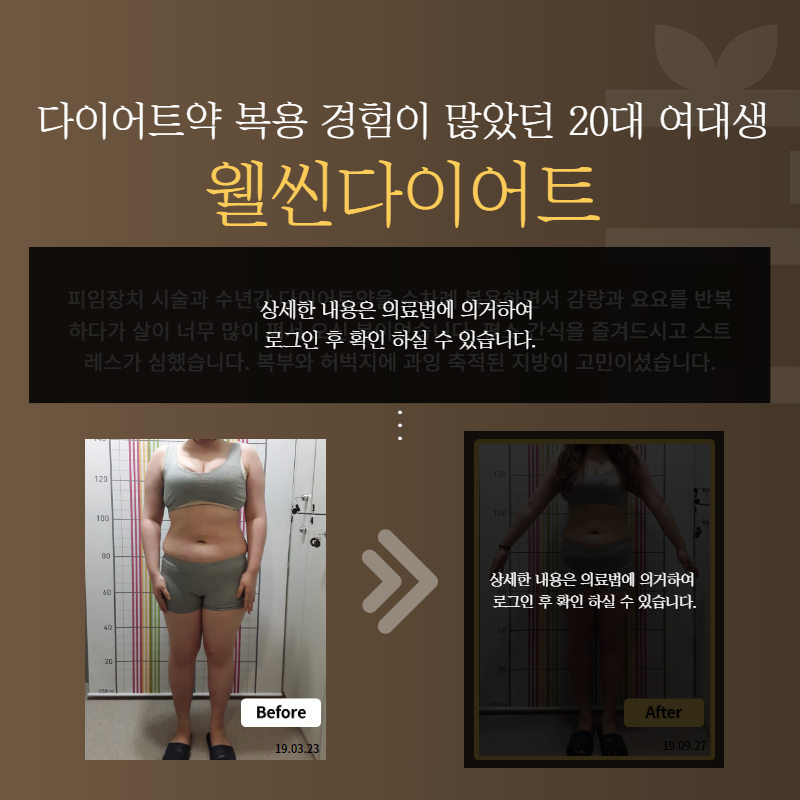 다이어트약 복용 경험이 많았던 20대 여대생 웰씬다이어트
