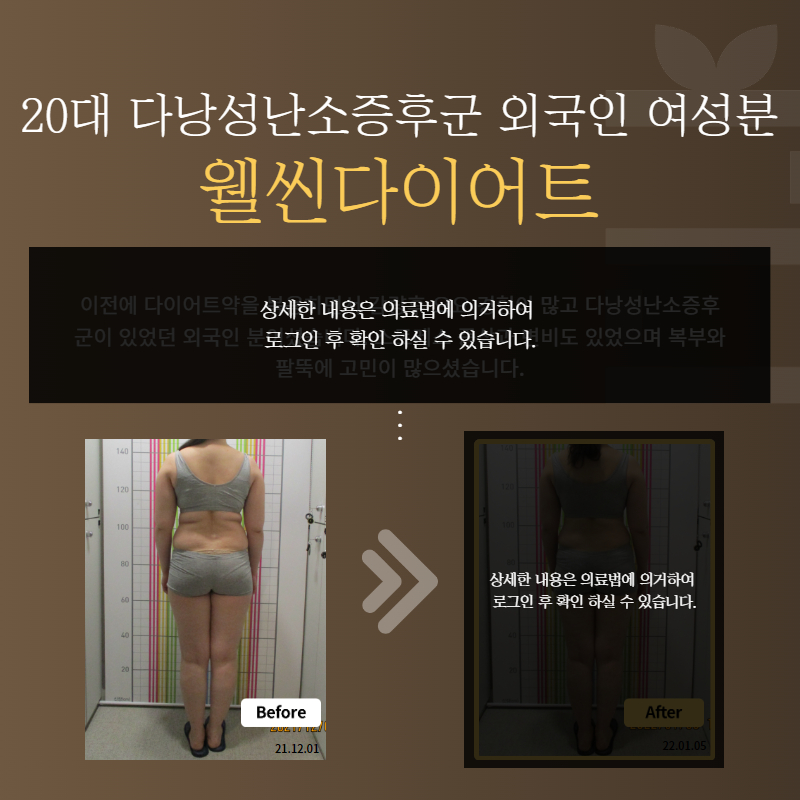 20대 다낭성난소증후군 외국인 여성분 웰씬다이어트