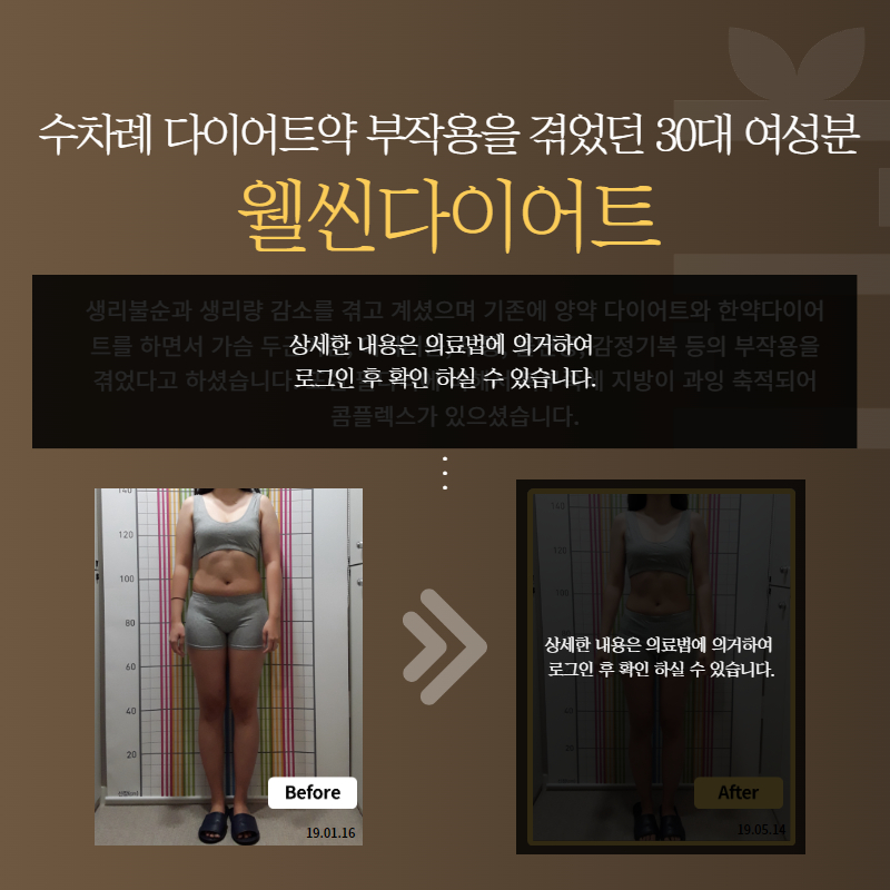 30대 수차례 다이어트약 부작용을 겪었던 여성분 웰씬다이어트