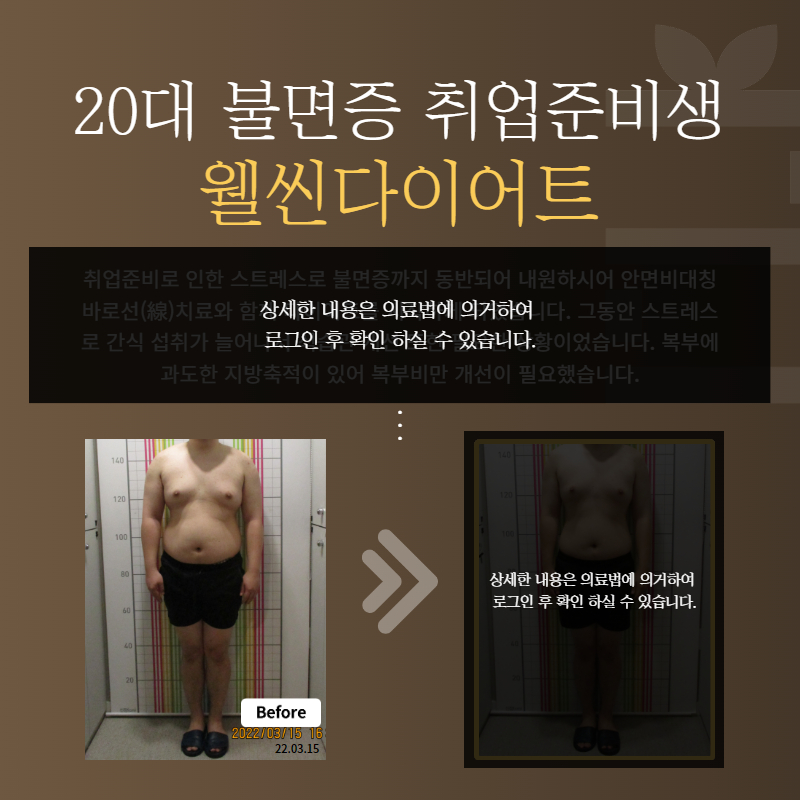 20대 불면증 취업준비생 웰씬다이어트