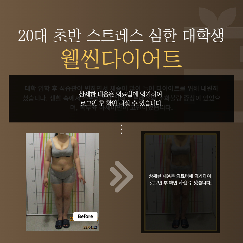 20대초반 스트레스 심한 대학생 웰씬다이어트