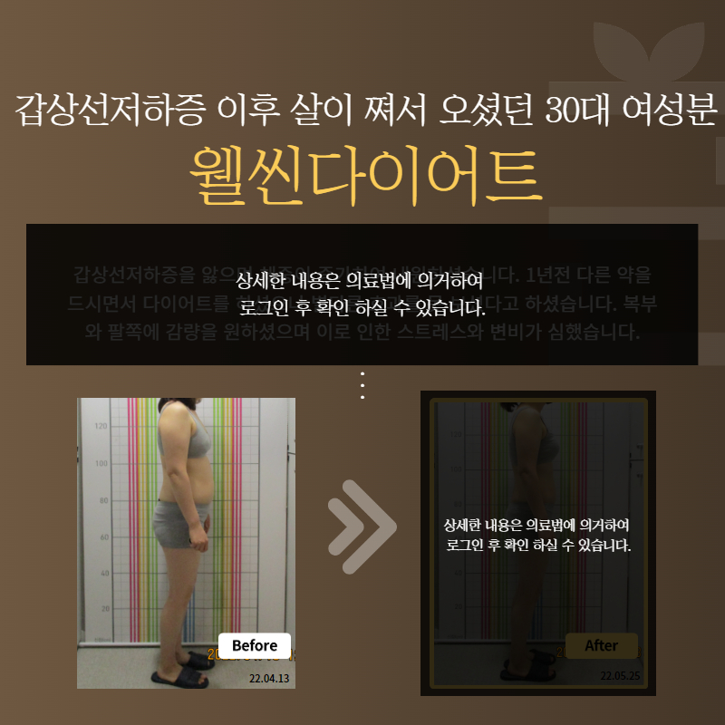 갑상선저하증 이후 살이 쪄서 오셨던 30대 여성분 웰씬다이어트