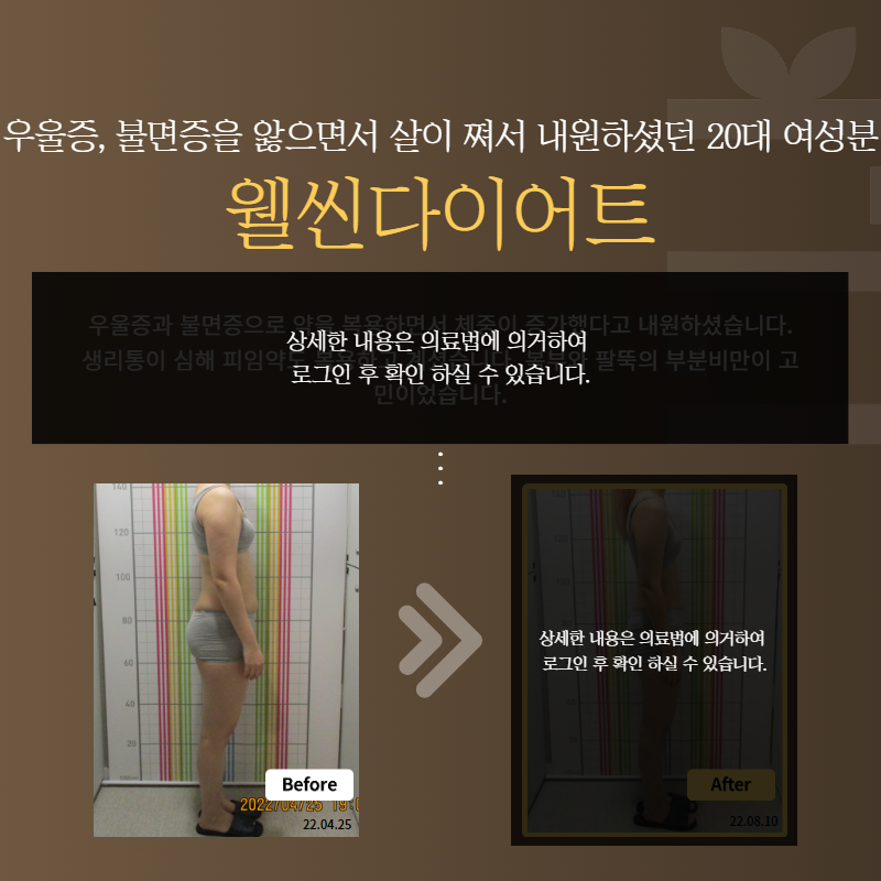 우울증, 불면증을 앓으면서 살이 쪄서 내원하셨던 20대 여성분 웰씬다이어트
