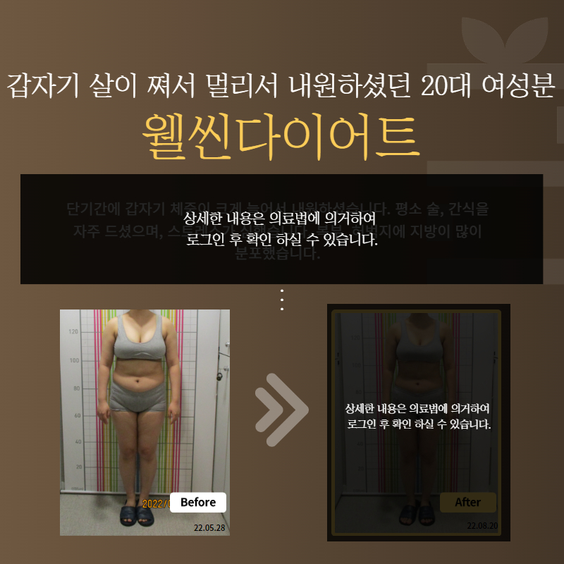 갑자기 살이 쪄서 멀리서 내원하셨던 20대 여성분 웰씬다이어트