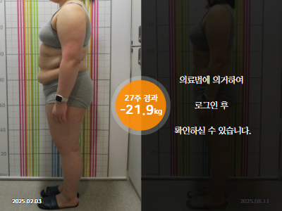 웰씬다이어트 [20대 여성] 27주 경과 총 -21.9KG 감량