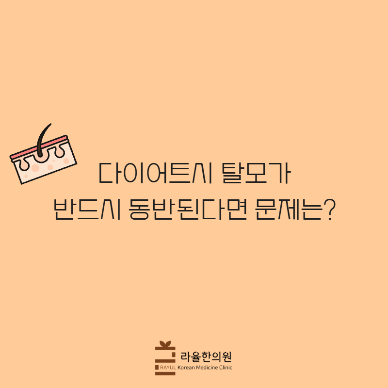 [칼럼] 다이어트시 탈모가 반드시 동반된다면 문제는?