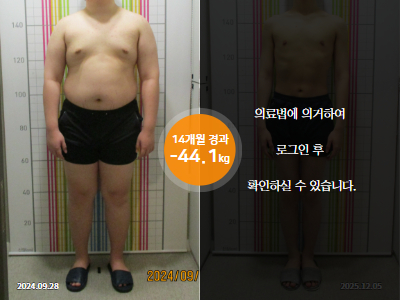 웰씬다이어트 [10대 남성] 14개월 경과 -44.1KG 감량