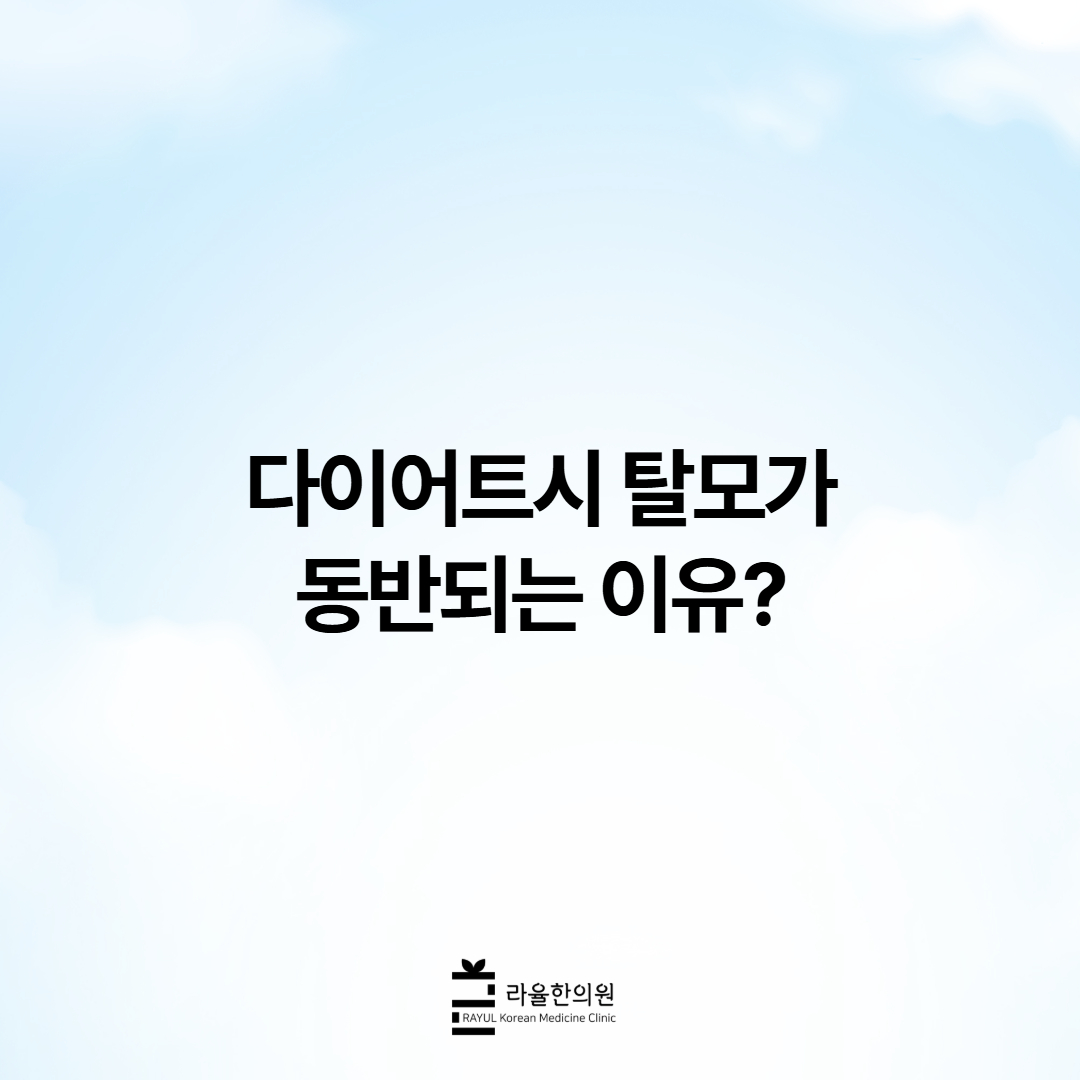 [칼럼] 다이어트시 탈모가 동반되는 이유?