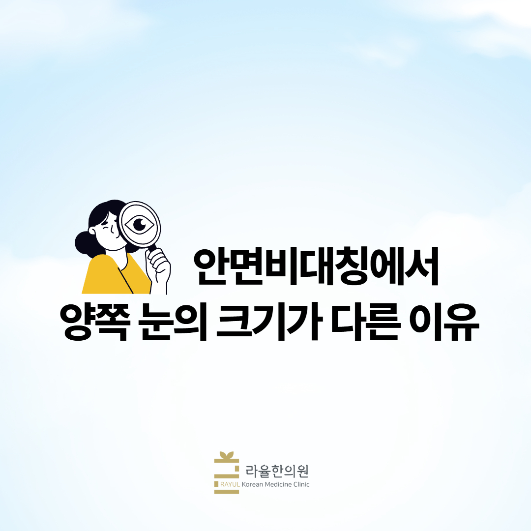 [칼럼] 안면비대칭에서 양쪽 눈의 크기가 다른 이유