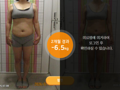 웰씬다이어트 [50대 여성] 2개월 경과 -6.5KG 감량