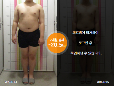 웰씬다이어트[10대 남성] 7개월 경과 -20.5KG 감량